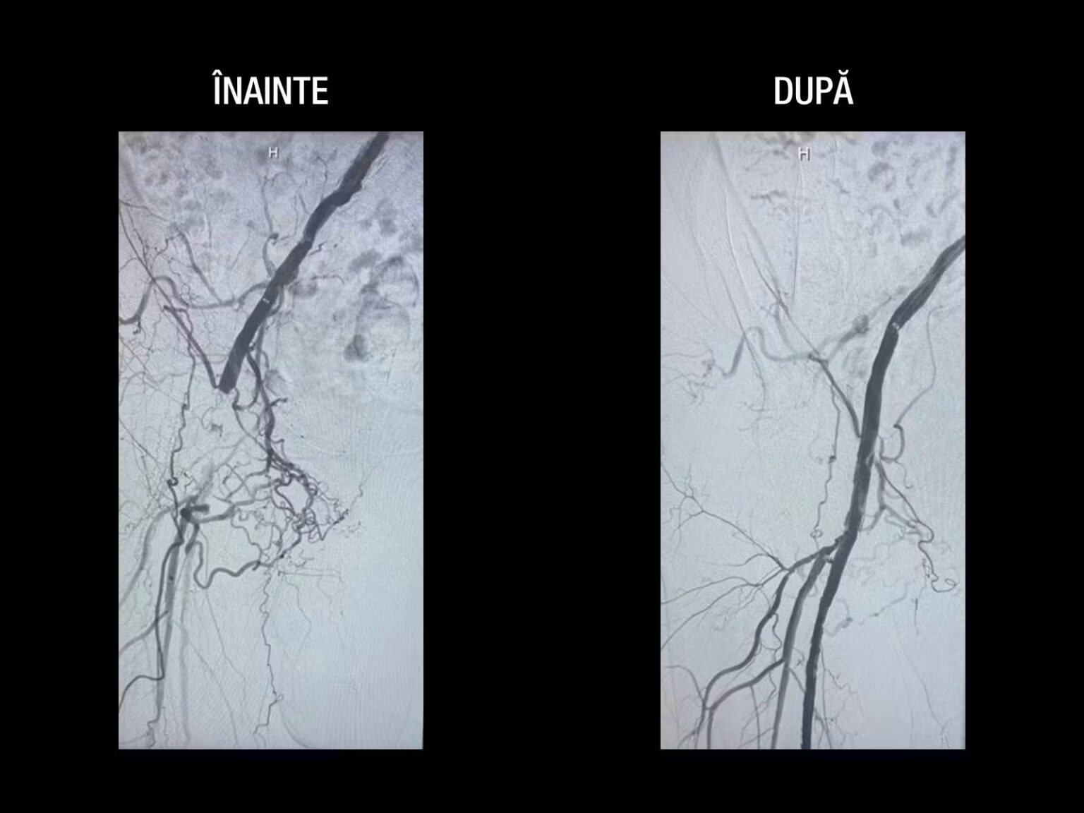 aV_V3QIvOtkhBG0e_poza6