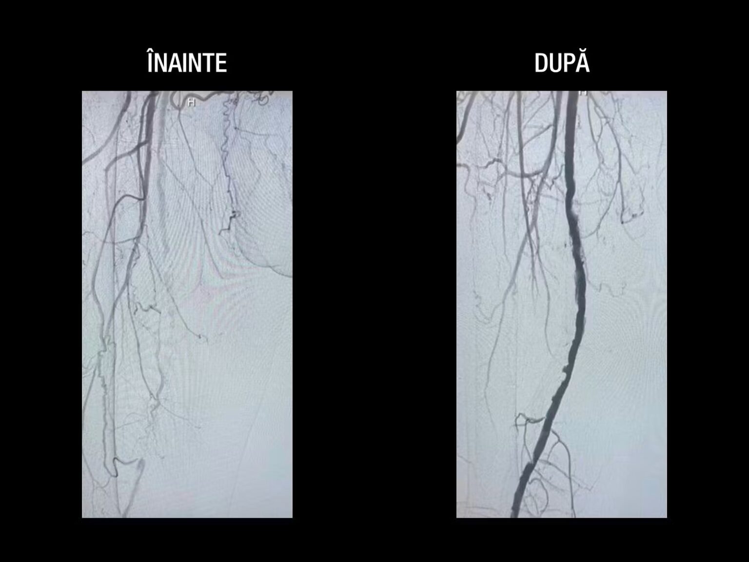 aV_V3gIvOtkhBG0f_poza7