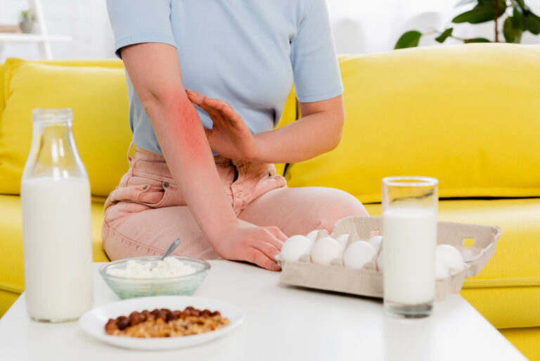 Cropped view of woman with allergy sitting near food on blurred foreground