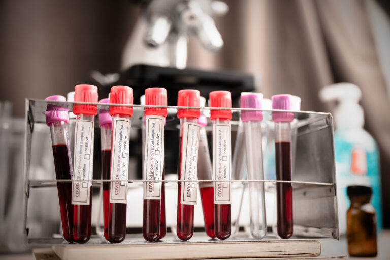  doctor in the laboratory for analysis and sampling of Covid-19 infectious disea