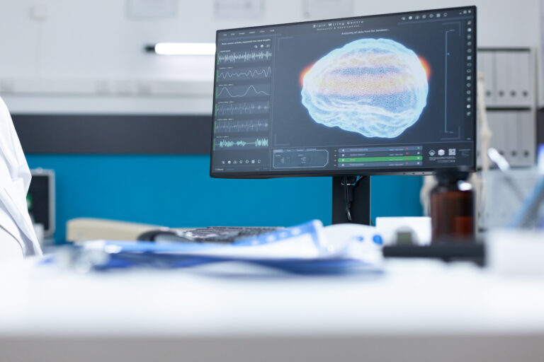 Modern empty hospital office having computer with mri brain diagaram