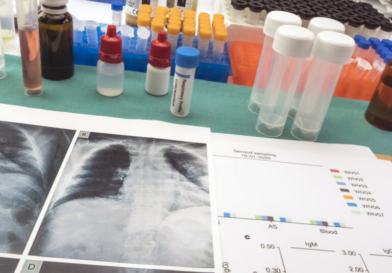radiographs with vial of blood of SARS-Cov-2 from an infected patient, conceptual image