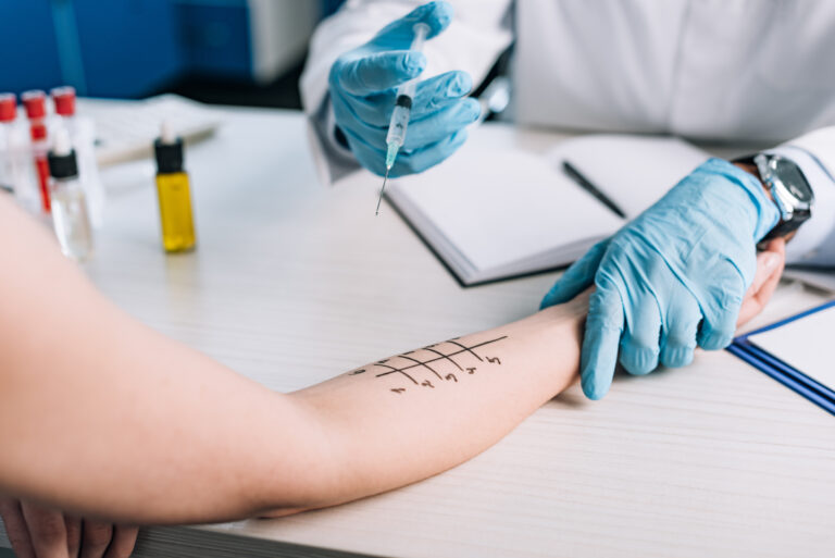 cropped view of allergist in latex gloves holding syringe near woman while doing allergy test in