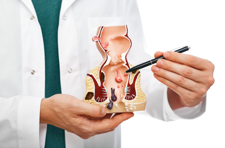 Treatment of rectal diseases, hemorrhoid