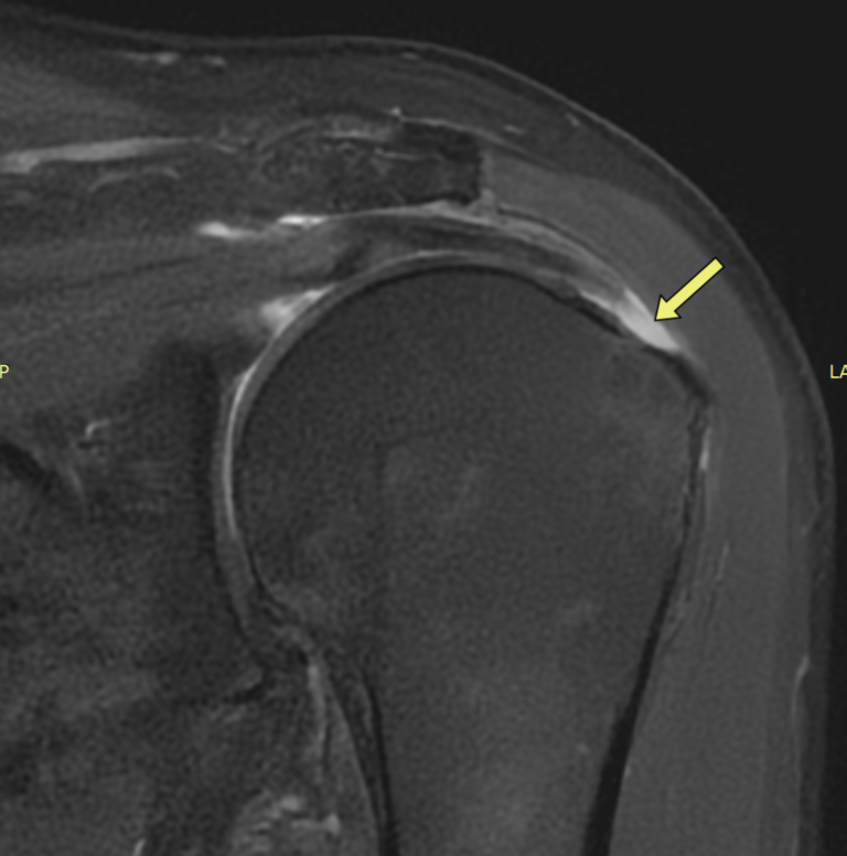 image2-2